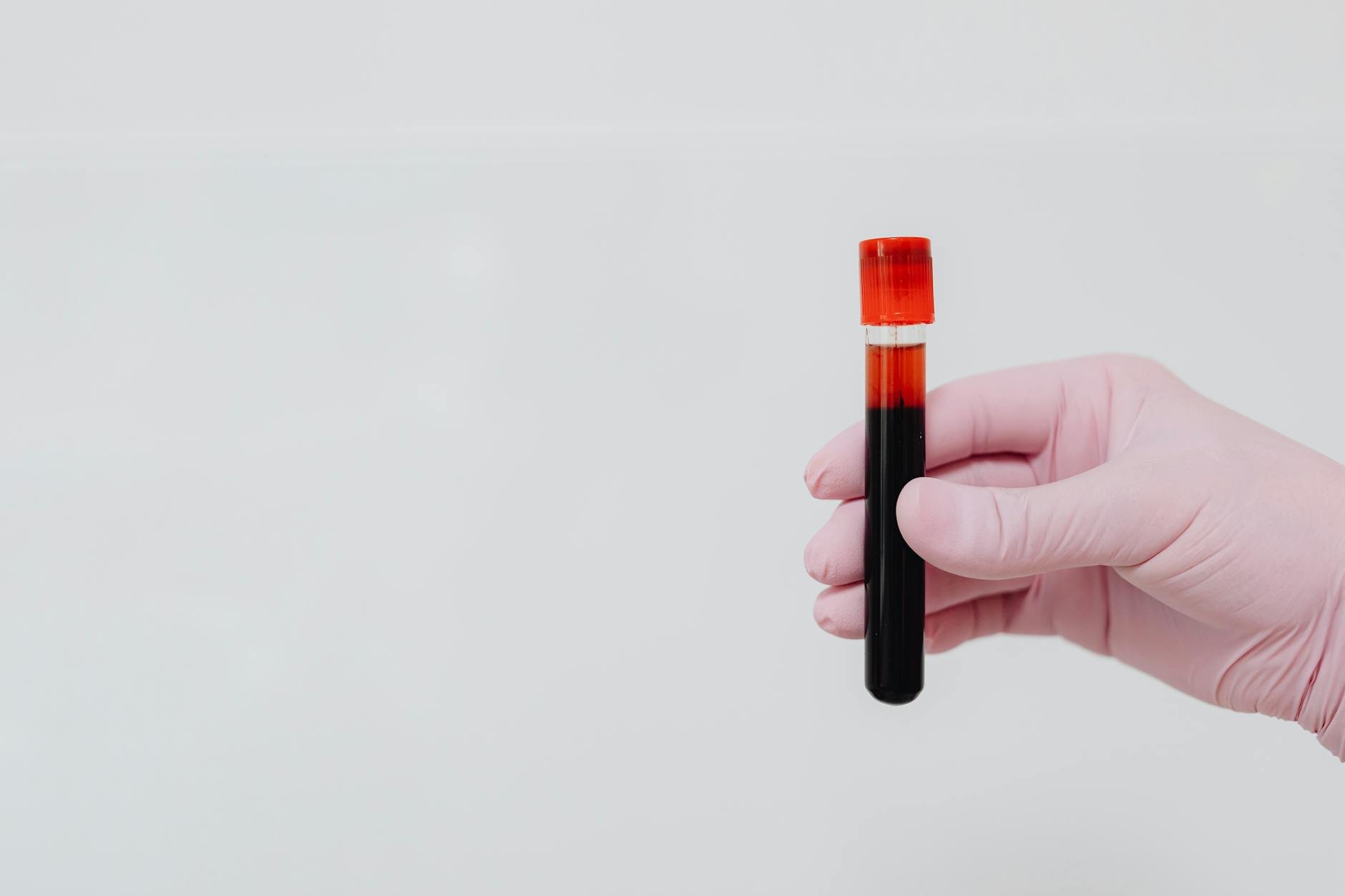 doctor holding a blood test vial with a concerned patient in a clinic - hidden causes low energy
