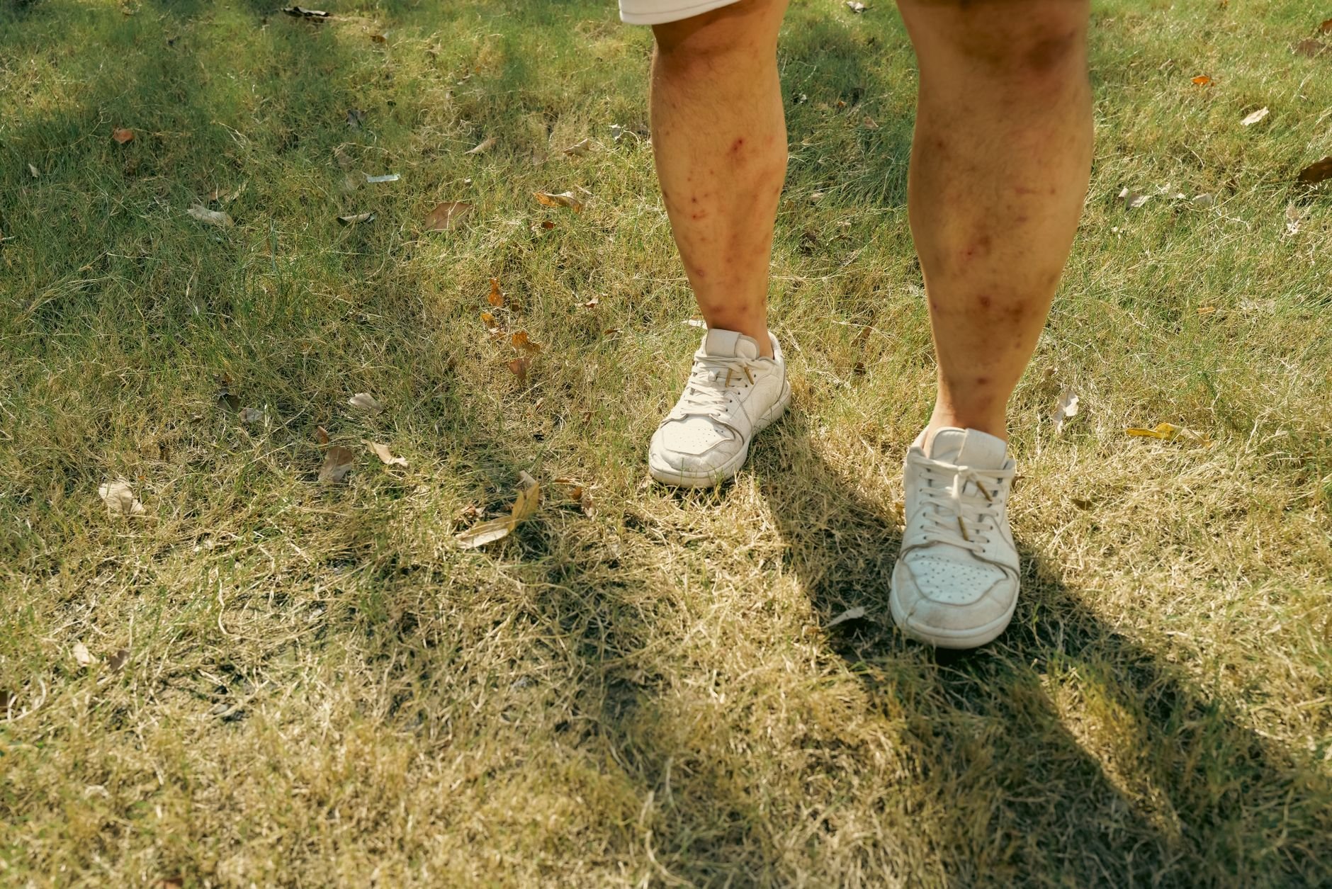 Person gently rubbing calf muscle due to cramp, focus on leg - Magnesium Deficiency Signs